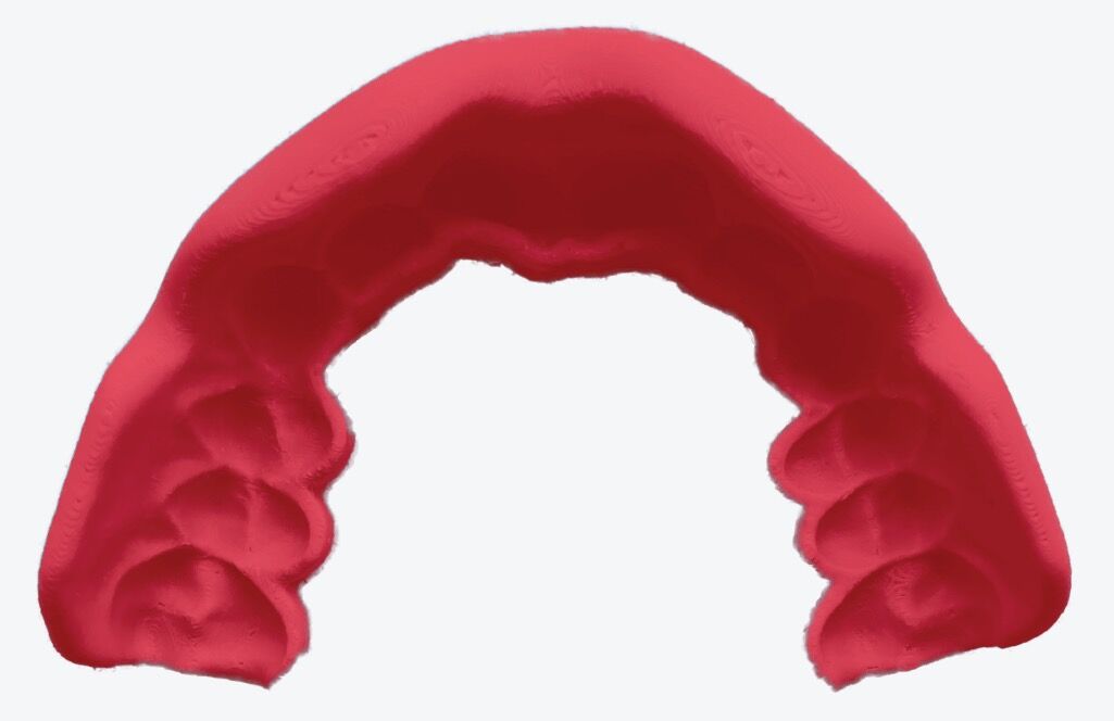 Elite-X Mouthguard, top view